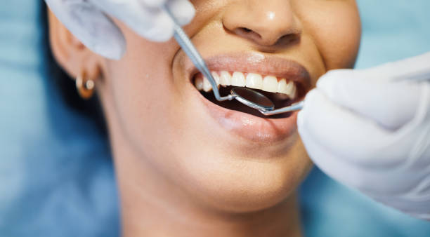 Best Knocked-Out Tooth Emergency  in Blair, NE